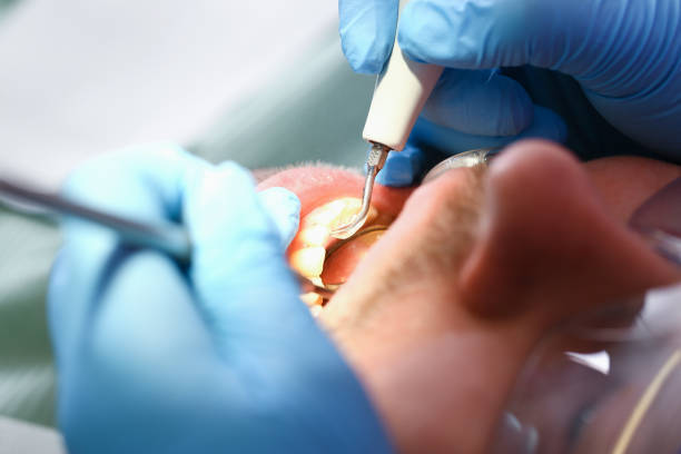 Best Pediatric Emergency Dentist in Ellington, MO