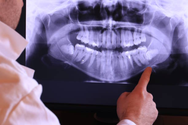  Ellington, MO Emergency Dentist Pros