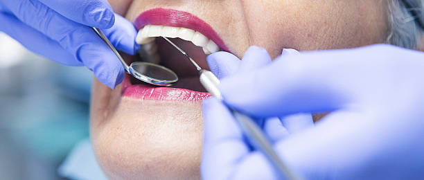 Best Weekend Emergency Dentist in Ellington, MO